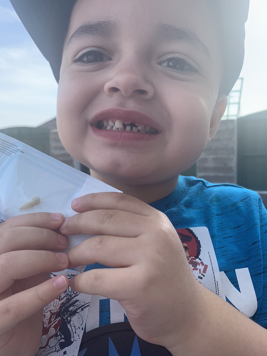 chloe41444943's tweet photo. Yesterday was a bad day! Xiah had to have his tooth removed and then snapped his collarbone ๐ญ๐ญ he was such a brave boy but in lots of pain ๐ #notmuchluck @Carolin63261632 @SnookMrs @Rhianno34442980 https://t.co/6h6q2PlMlx