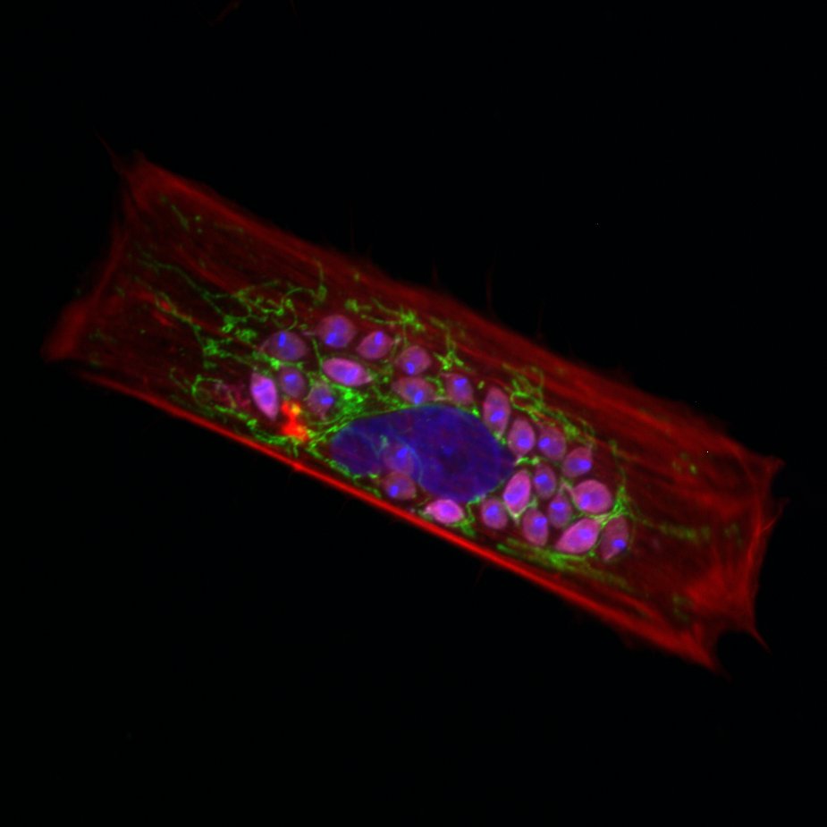 Nicolas3474's tweet image. Digging through old goodies from my internship in @BBurleighChagas lab ! #micropattern #trypansomacruzi 🔬🦠