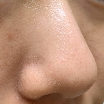 グリセリン スキンケアで毛穴が黒ずむ原因は水性基剤だった プロパンジオール 目指せ毛穴レス いちご鼻と戦うちゃんの奮闘ブログ