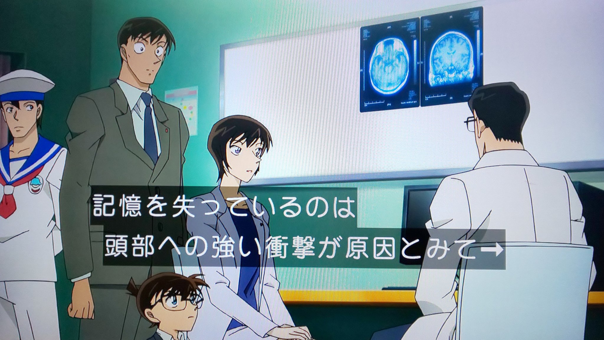 睦月 佐藤刑事が妊娠して高木刑事と一緒に 診断結果を聞いている様に見えなくもない かもしれない 金曜ロードショー 名探偵コナン 純黒の悪夢 T Co Ehqiuruqke Twitter 睦月 佐藤刑事が妊娠して高木刑事と一緒に 診断結果を聞いている様に見えなくもない かもしれない 金曜ロードショー 名探偵コナン 純黒の悪夢 T Co Ehqiuruqke Twitter