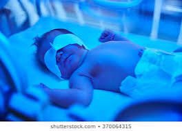 Phototherapy is a treatment with a special type of light (not sunlight).Sometimes used to treat newborn jaundice by lowerin the bilirubin levels in your baby's blood thru a process called photo-oxidation. Photo-oxidatn adds O2 to the bilirubin so it dissolves easily H20 (google)