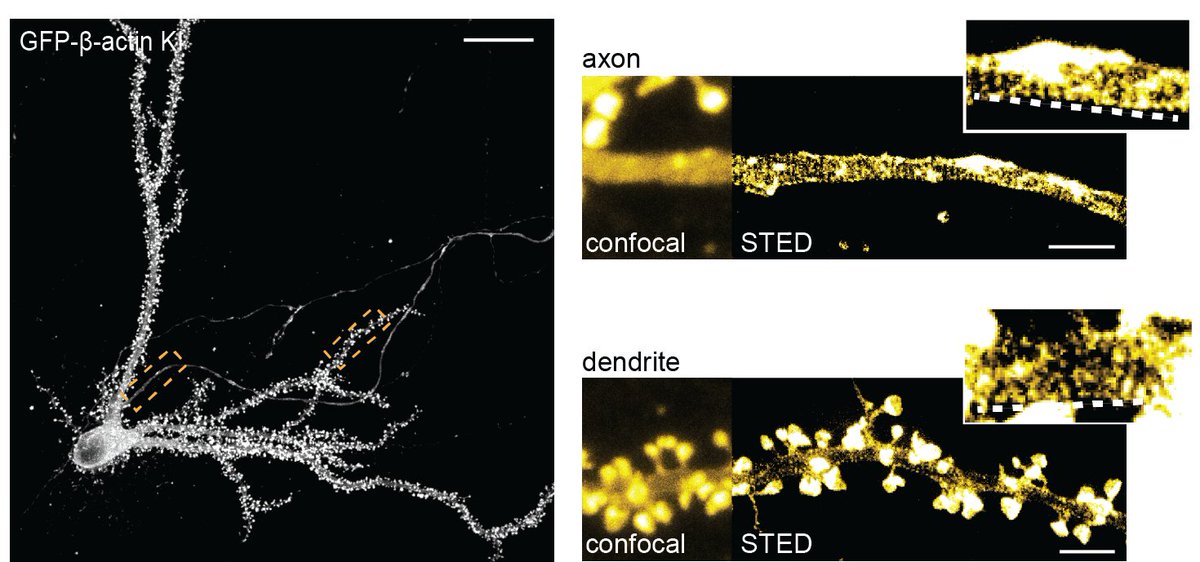 hdmacgillavry's tweet photo. Our paper describing ORANGE: A CRISPR/Cas9-based genome editing toolbox for epitope tagging of endogenous proteins in neurons, is out now in #PLOSBiology! https://t.co/KTuRljbww9 
Fantastic work by @Jelmerwillems and Arthur de Jong in the lab, many thanks to all who contributed! https://t.co/VetXtWmTMy