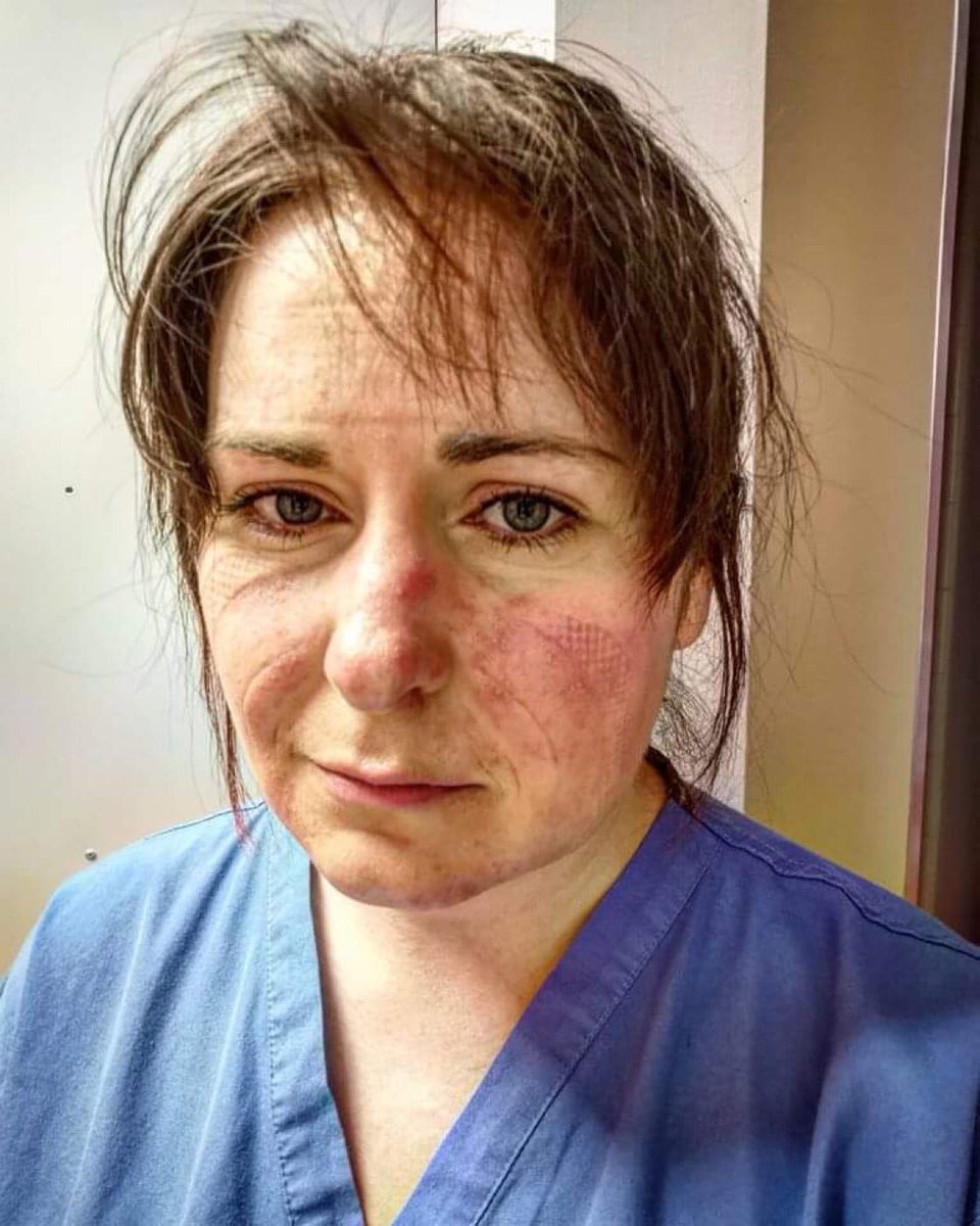 EngagementRaf's tweet photo. #RespectNHS #RealNews - the battle continues ๐๐ฝ๐๐พ๐๐ฟ๐๐ป๐๐ฟ๐๐พโจโจโจ https://t.co/kScjt6x4zr