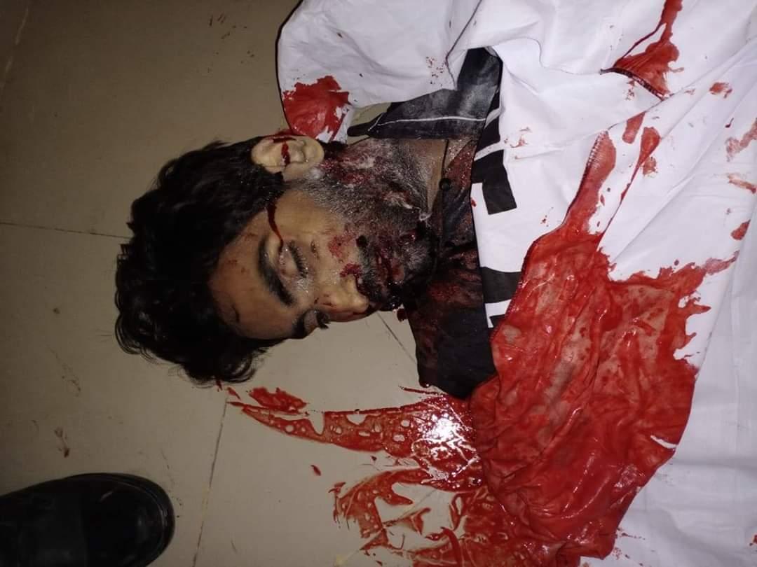 Terrorist that died. They were residents of Karachi. Local occupation govt. is covering up calling them "Tourist died in accident road" show a 4 seater car.How can 4 died and 7 injured can seat in 4 seater car... Idiot POK govt.