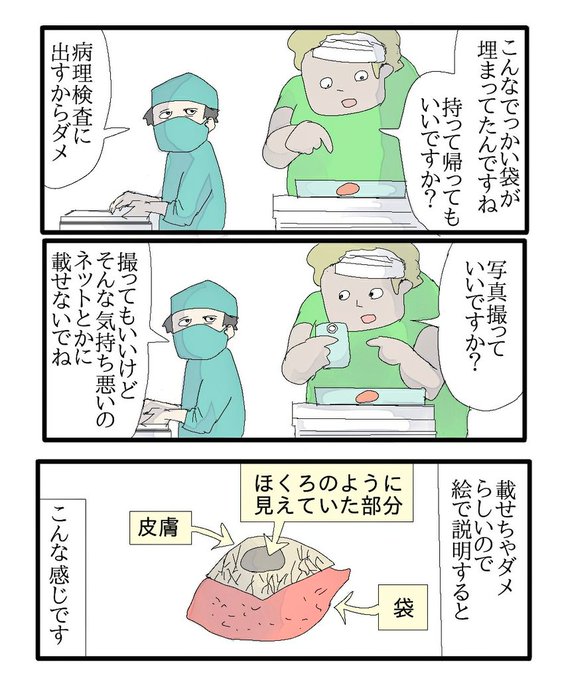 粉瘤のtwitterイラスト検索結果 粉瘤のtwitterイラスト検索結果