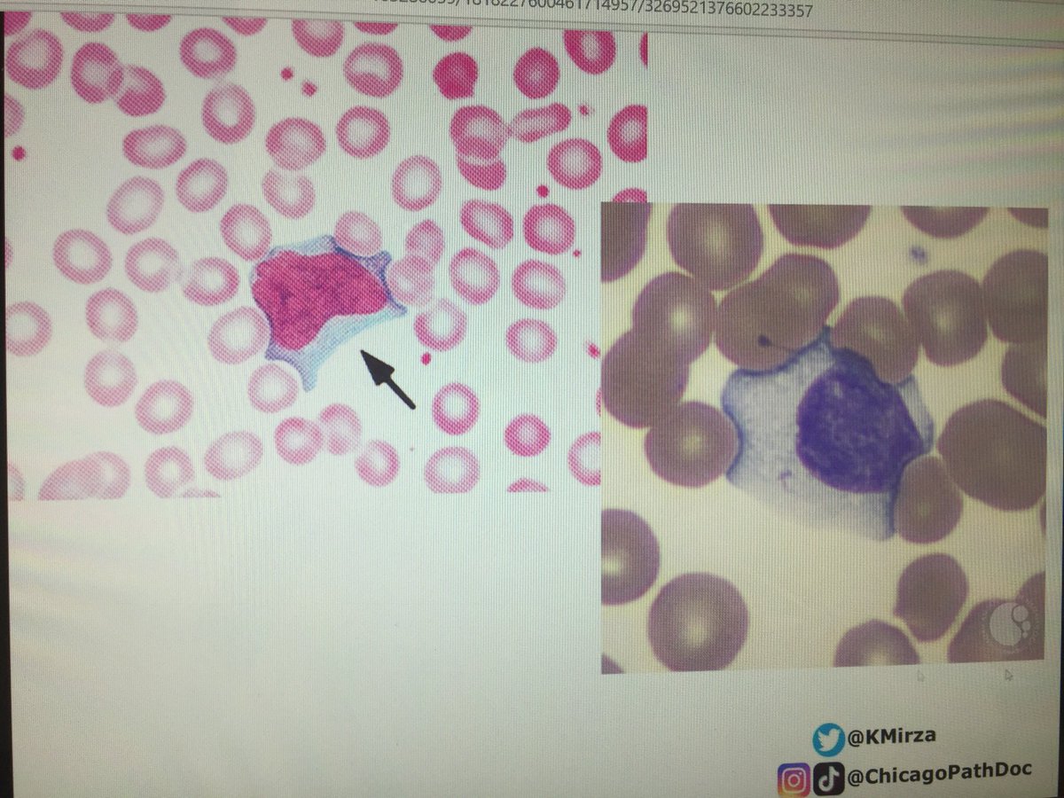 IHC_guy's tweet photo. @KMirza says no to kissing, but it’s OK to give a warm embrace.

#DadJokes #RadJokes #CAPVirtualPath #PathTwitter @UIPathology https://t.co/ZJ4X8pJV1X