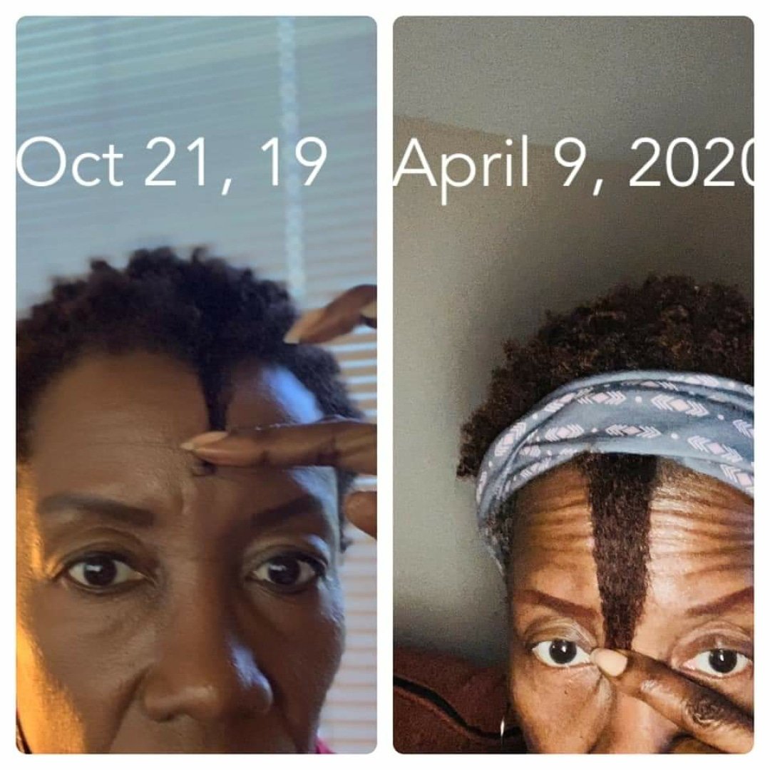 PhamilyHair's tweet photo. https://t.co/DbRMpuksm7
#theshrinkageisrealbutsoisthegrowth #growthcheck
#4c #lowporosity #twa #photogenichaircare #phamily #naturalista #naturalhair #allnatural #crueltyfree #hairtransformation #conditions #growthserum #curldefinition #edgecontrol #stylinggel #blowoutcream https://t.co/TJ36BAX4aU