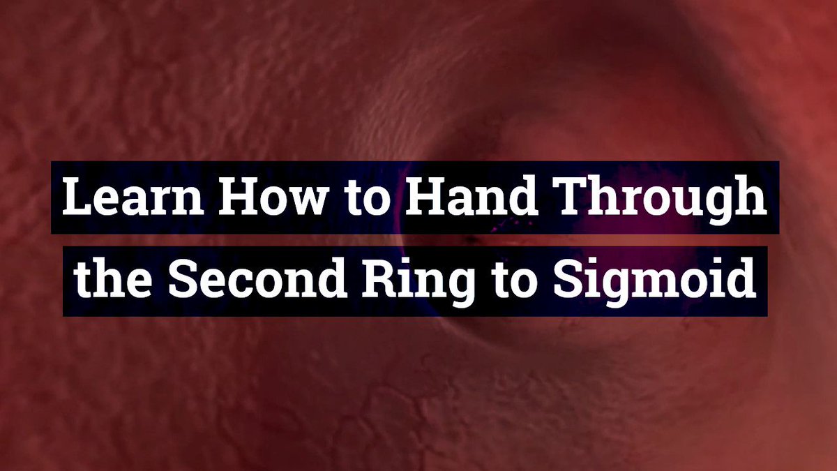 fistfy's tweet photo. Learn How to Hand Through the Second Ring to Sigmoid – Learn Anal Depth Fisting skills fast and safely!  

Take a look now: https://t.co/Fyq2SbHF2V

#depthfisting #secondRing #sigmoid #analfisting #Fisting #gay https://t.co/OzVvHtIJj8