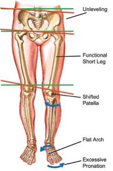 The patella on the short leg can also shift laterally & cause the tibia to compensate into internal rotation, causing excessive pronation & therefore poor propulsion on the short side leg as well.This thread helps explain that asymmetries need to be managed if there’s..(5/6)