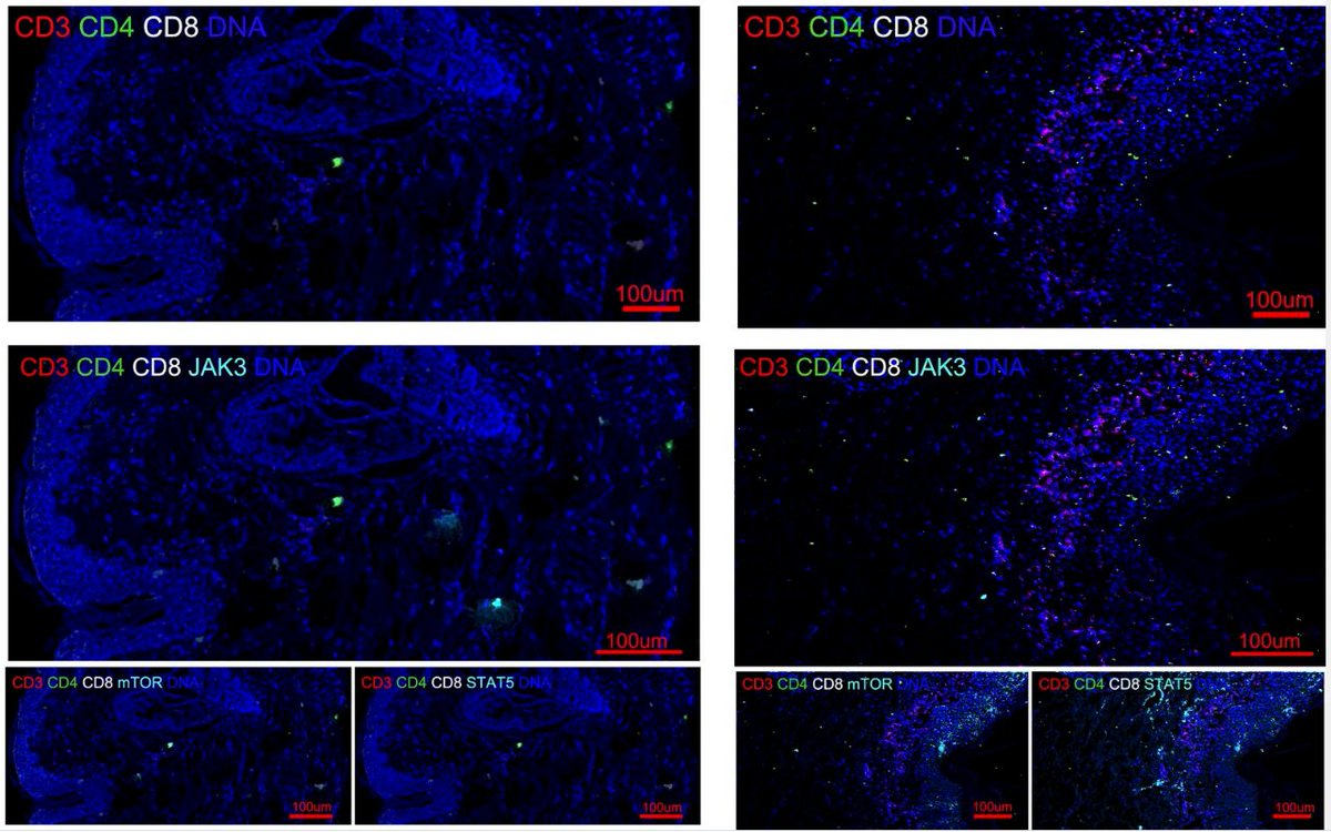 Standard_BioT's tweet photo. #highdimensionalimaging: Shanghai Jiao Tong University School of Medicine researchers used #singlecell #masscytometry and #imagingmasscytometry to characterize cells and signaling pathways associated with psoriasis.
Read the paper: https://t.co/B6rKDI7wrH https://t.co/WgttvCOjgE