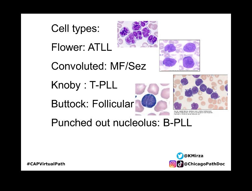 DocBarbieMD's tweet image. Hematopathology!! 🥰. Today’s CAP rapid 🔥 board review. I can’t wait to do a rotation and fellowship in Hempath! Thank you @KMirza for this lecture! #CAPVirtualPath #pathology #hempath