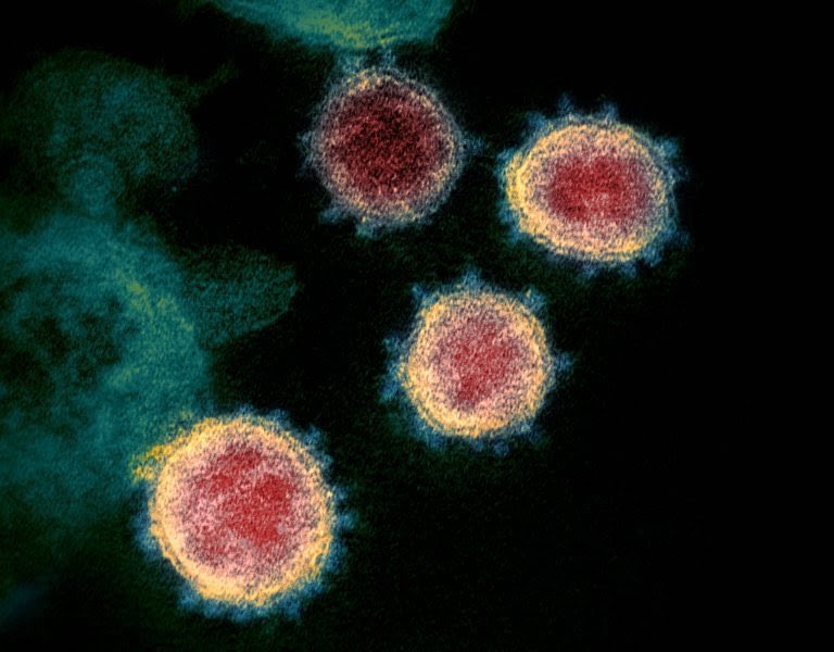 Teknosciences's tweet photo. L’ivermectine, un antiparasitaire utilisé depuis 40 ans, tue le coronavirus en moins de 48 heures en laboratoire
https://t.co/8DOlK2qlZk https://t.co/Xh93WXzIke
