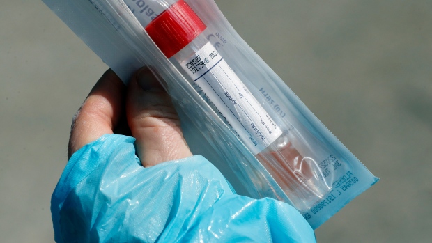 City confirms another 122 cases of COVID-19, 23 more deaths  https://www.cp24.com/news/city...