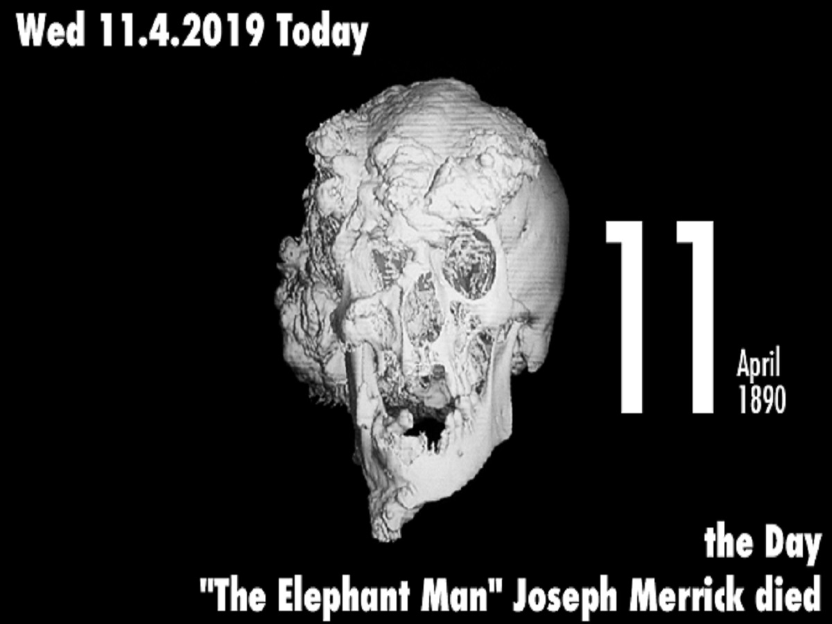 エレファント マン 画像 Danielmurrinjp