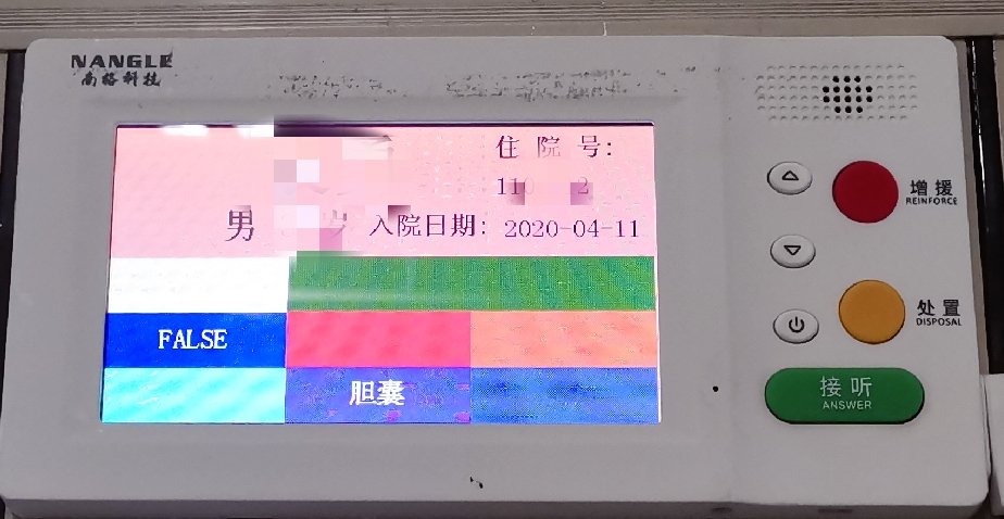 aLonely大蓝鲸 tweet media