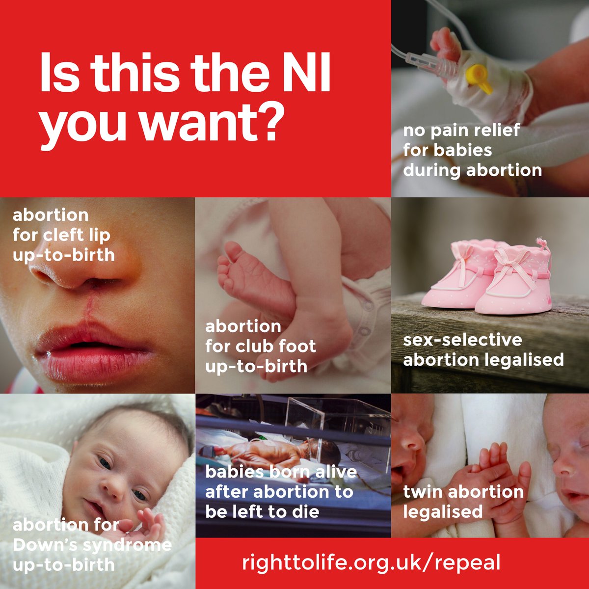 RightToLifeUK's tweet photo. Is this the Northern Ireland you want?

Save lives! Tell your MLA and MP to repeal this extreme abortion regime.

#SaveLivesRepeal https://t.co/USpm9Za3sx