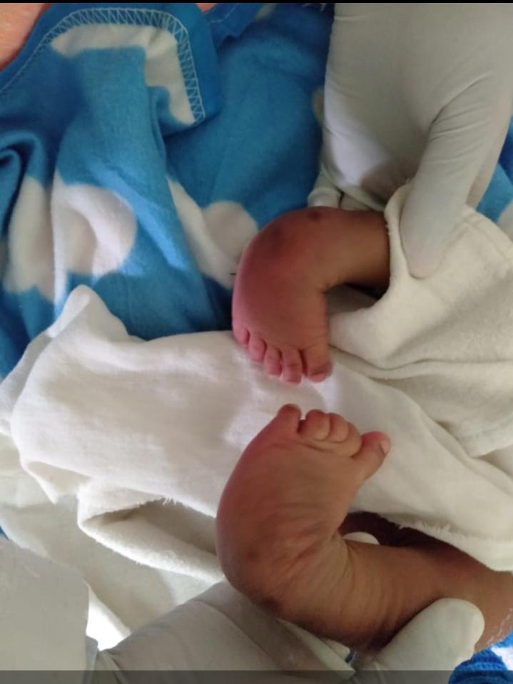 Josep_Opicho's tweet photo. #recognizeorthotrauma...they correct this congenital disabilities https://t.co/mcaAyTqk1i