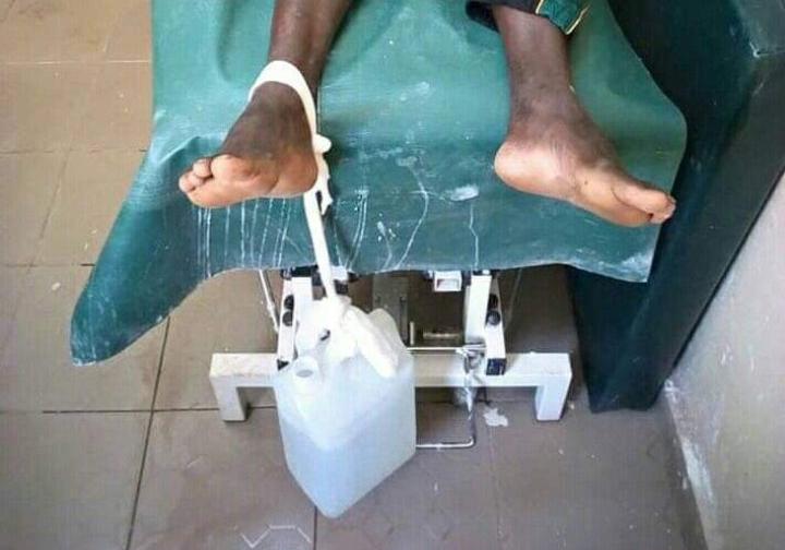 #recognizeorthotrauma ...to the  @ MOH, what kind of fractures or orthopaedic condition is managed this way???