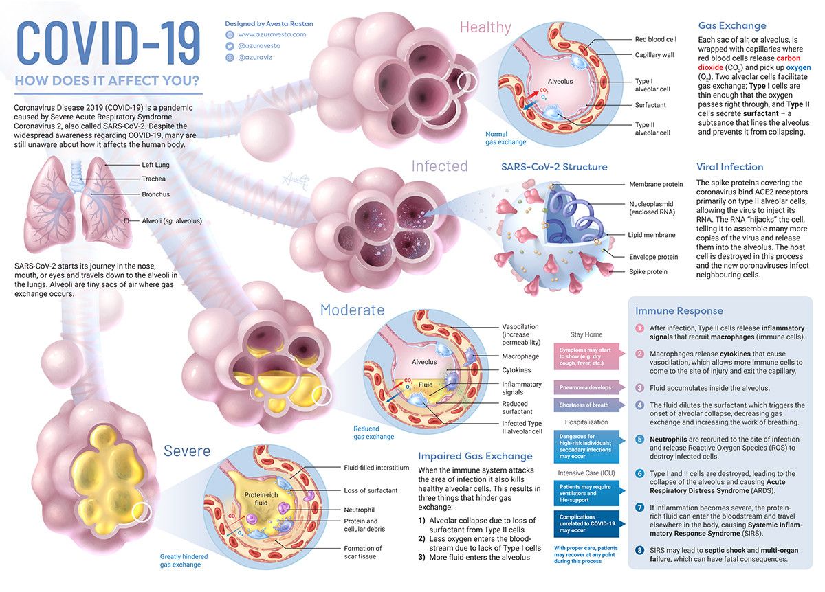 wef's tweet photo. This visualisation shows what COVID-19 does to your body https://t.co/wxmg3gTDLJ #coronavirus #covid19 https://t.co/6ysoDXFpe2