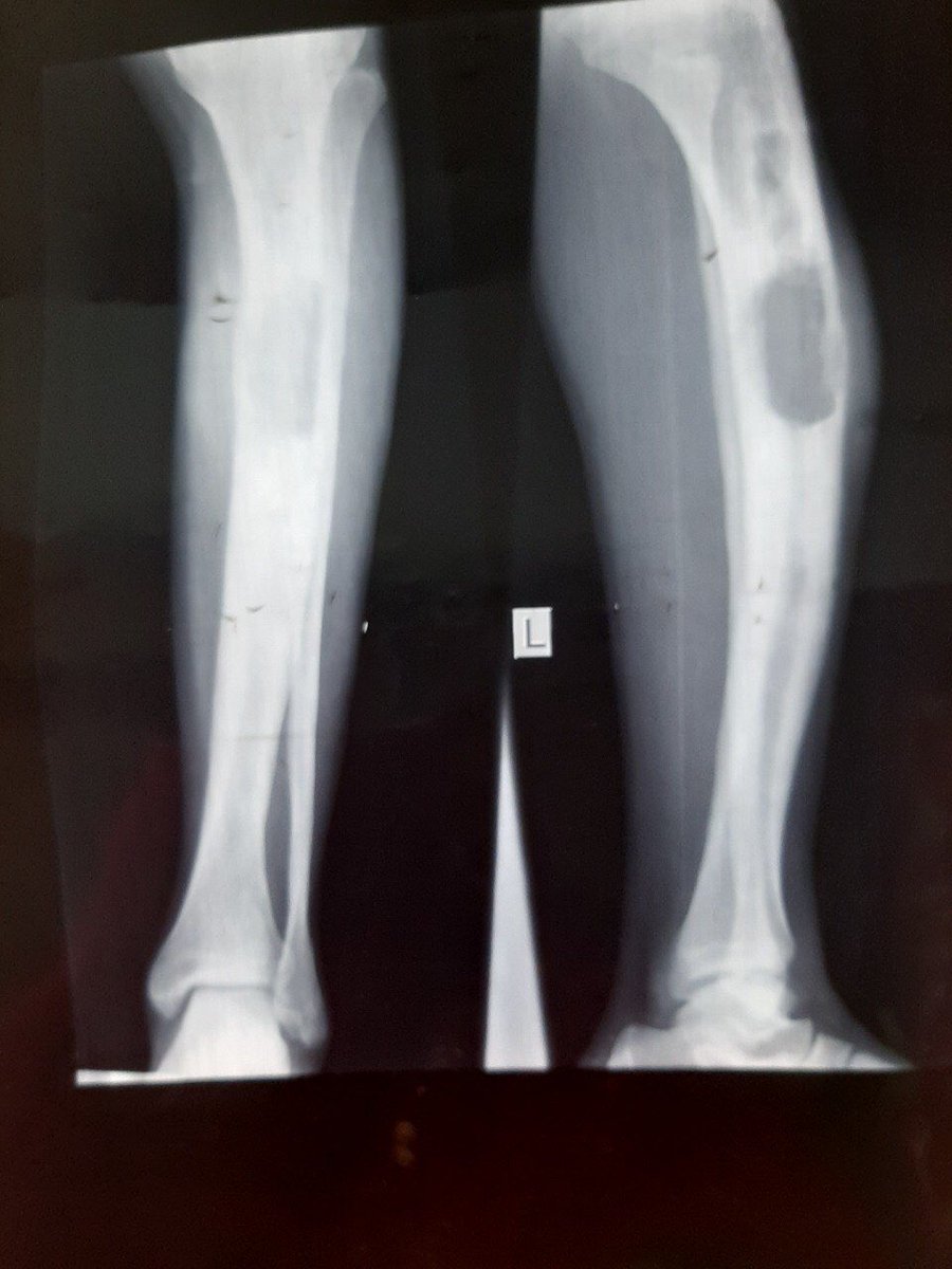  @DrGeeONE  @01sth02  @nusrat_xahra  @Teddy_wub  @SarasSreeram Do we know any rad colleagues that could help us interpreting this please
