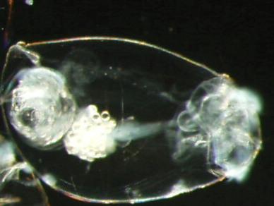 To make it competitive, we'd have to split up the coolest ones: Daphnia (obvs), Leptodora, Holopedium, and Asplanchna (look at me being all diverse and including a rotifer; photo is an Asplanchna)