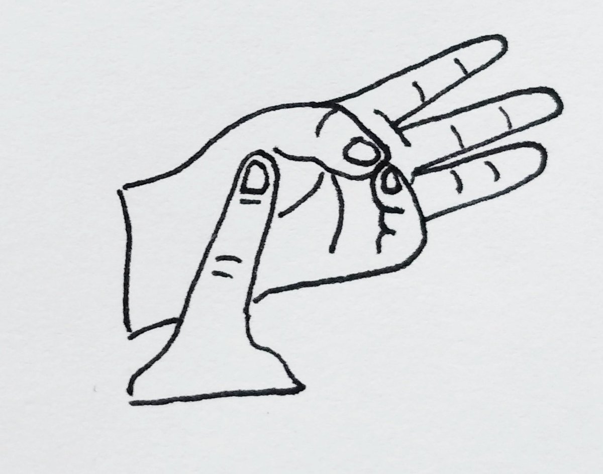 Muy hecho (well-done):A 74°C, la carne es más dura, seca y oscura a medida que se coagulan más proteínas y desaparece la humedad de las células.La carne tiene el tacto de la base del pulgar cuando haces que se toquen el pulgar y el meñique. Se cocina unos 6 min por lado.