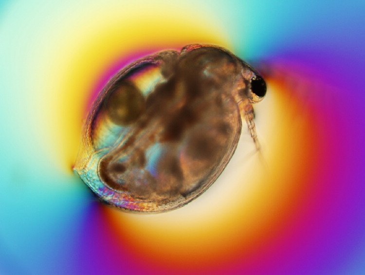 Has anyone made a lake zooplankton quarantine house challenge? Because, if not, I think I know what I'm doing this weekend.  #ExtremelyNicheQuarantineHouses (Photo is an infected Ceriodaphnia)