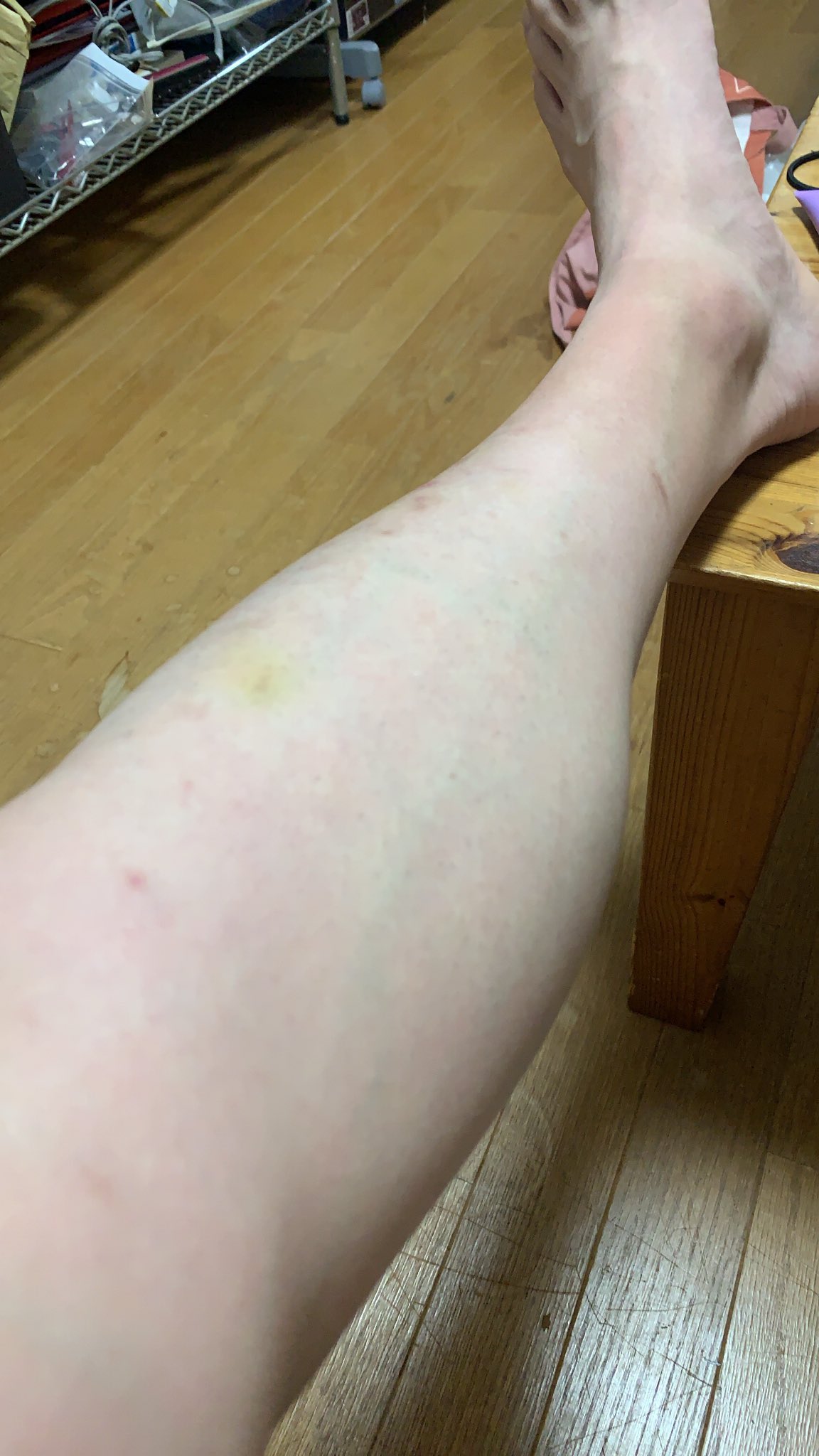 Shingo 彼女の除毛クリームふざけて使ったらすね毛が消えた T Co Gfzun08fpp Twitter