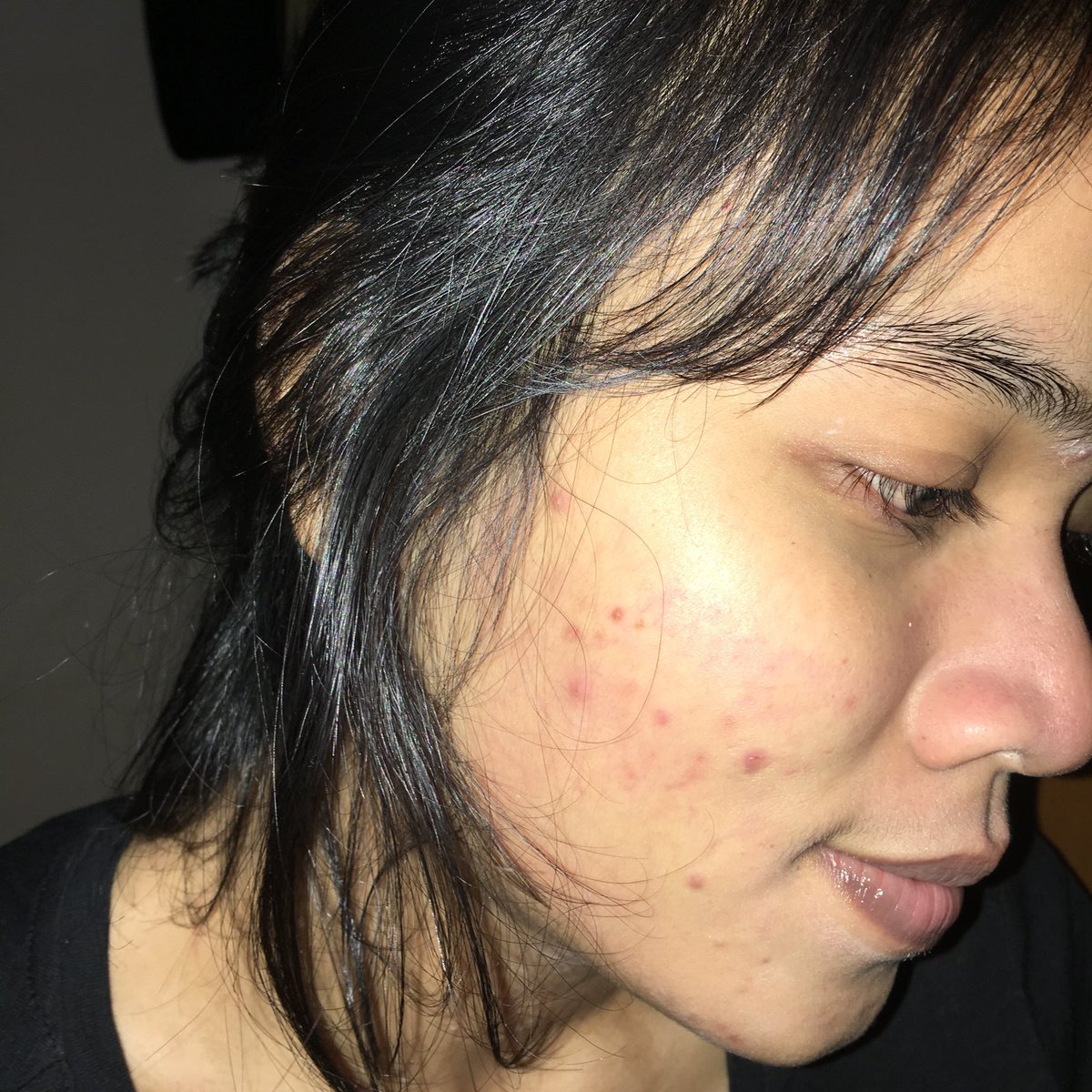 niluhhhhhh's tweet photo. Buat yg capek gonta-ganti skincare, tapi komuk masih gitu-gitu aja, nih aku kasih tau rahasianya. My from this to this hanya dengan ES BATU!❄️❄️❄️ https://t.co/PC0xkSVN6w