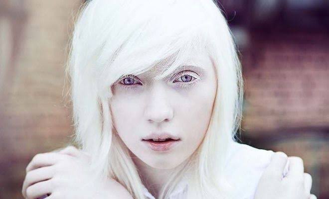 歪hizumi アルビノの方は凄くかっこよくて憧れます アルビノの方の苦悩とかそういうのは理解できないし 理解できない上で カッコいいというのも失礼と思われるかもしれないけど 別にそういうのは関係なく 一人の人間として見たときに 神秘的な