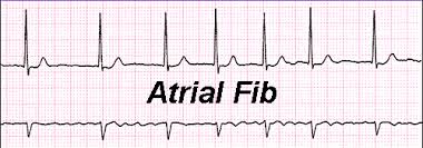 ZDogg's an MD who understands the BIG PICTURE & the  #Economics the USA's $3.2 trillion oligarch scam."Because that's what our system's in now - rapid irregularly irregular atrial fibrillation with no hope of cardioversion without a dramatic event - & here's our dramatic event."