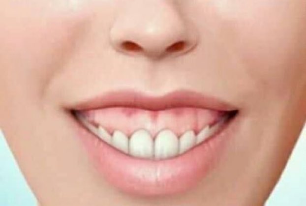 IsabelSteckel's tweet photo. how come every bitch with these gums has a cousin who works at the CDC https://t.co/mUWFcg60Sw