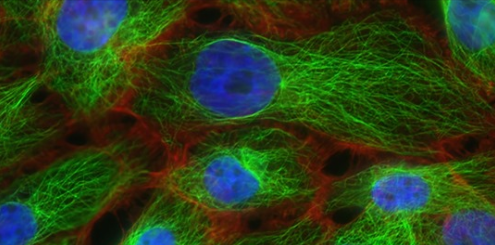 Fissac_es's tweet photo. ✅Puesto que un ambiente hipóxico y una red vascular disfuncional aceleran la progresión del cáncer, el ejercicio debería ser una herramienta a tener en cuenta en algunas etapas del tratamiento debido a que es capaz de modular el microambiente tumoral.
👉https://t.co/G7gWL9NRwE https://t.co/mVSIaus7VU