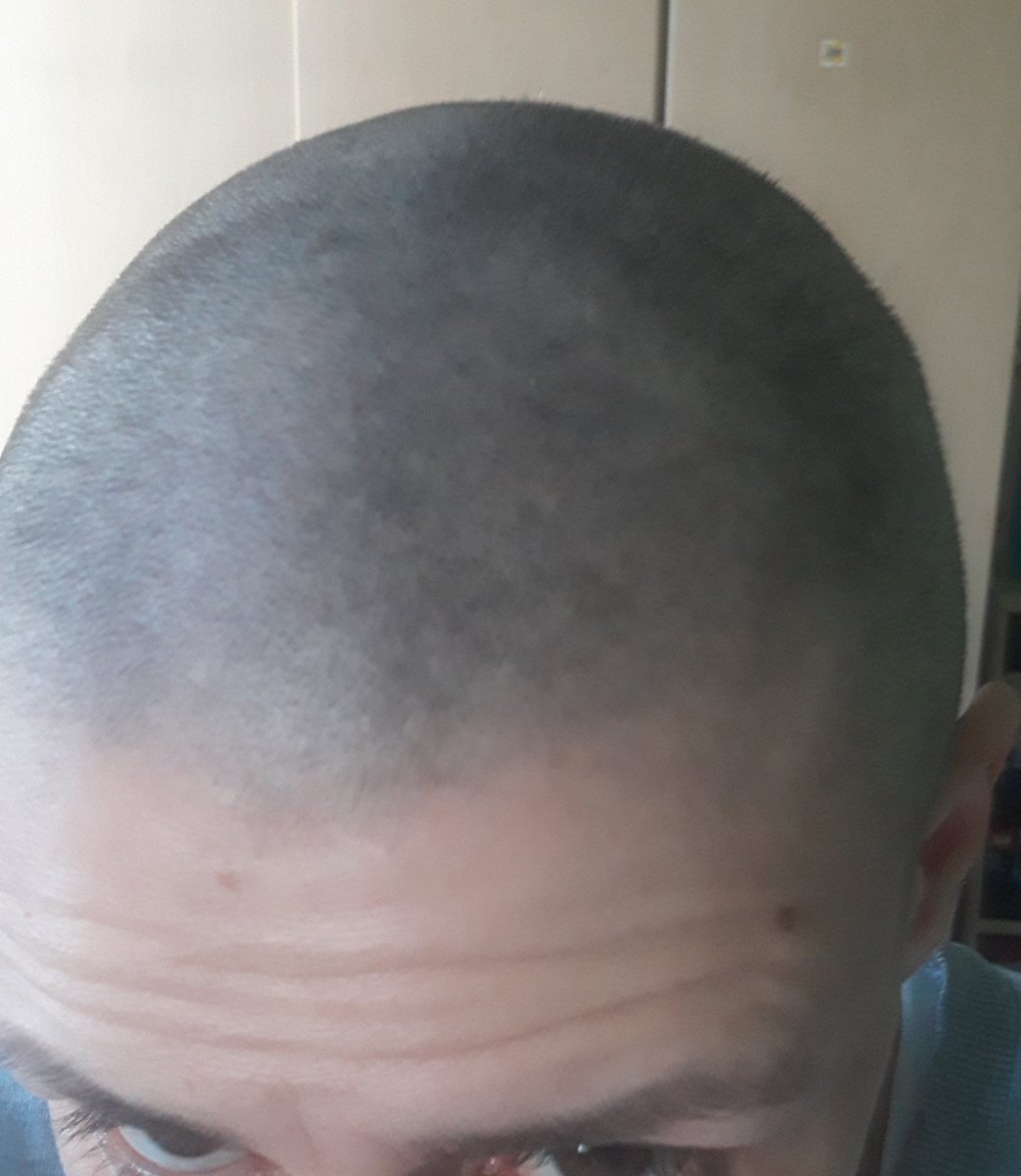 karlaktx's tweet photo. I celebrate the end of my chemo with a new haircut. I promised to do it when/if it's over in honor of everyone out there who's still fighting. 
Stay strong and positive! Never stop dreaming and fighting, cause we know live is not fair and in the end of the day everyone + https://t.co/OEhcgQzaWZ