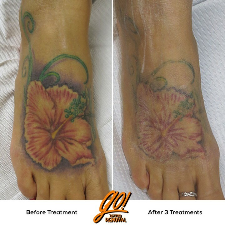 How to Care for a Foot Tattoo  Arizona Red Mountain Footcare