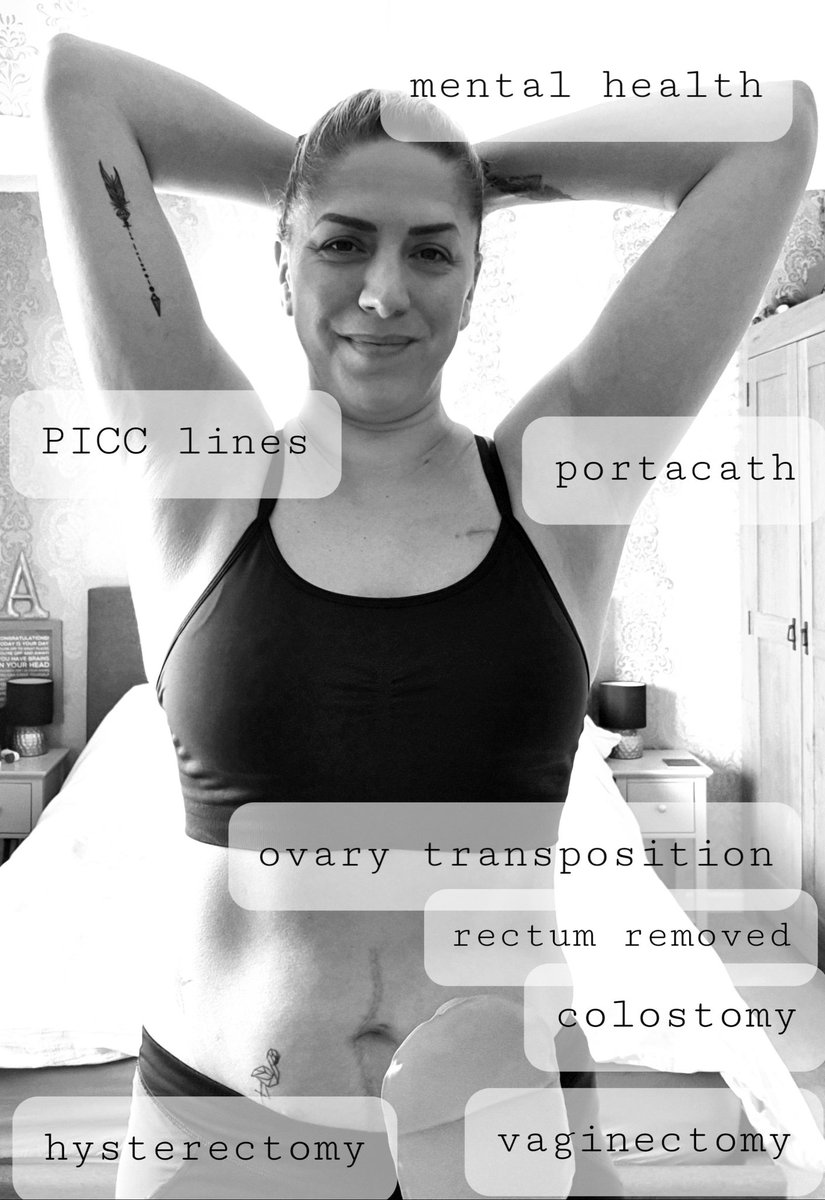 DC_Protts's tweet image. In amongst the #CONVID19 chaos, it's bowel cancer awareness month.  I wanted to share what cancer looks like, and beg that if you have ANY symptoms please go to your GP.  Mine was missed. I am now stage 4 and incurable. #never2young #bowelcancerawareness @bowelcanceruk