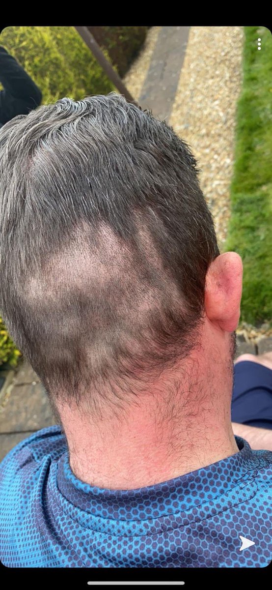 Hmmm, think I best just stick to the day job👩‍💻. Fair to say I’m no Barber💈✂️🤣#homehaircutsgonewrong #whoops #StayHomeSaveLives #GoodFriday2020