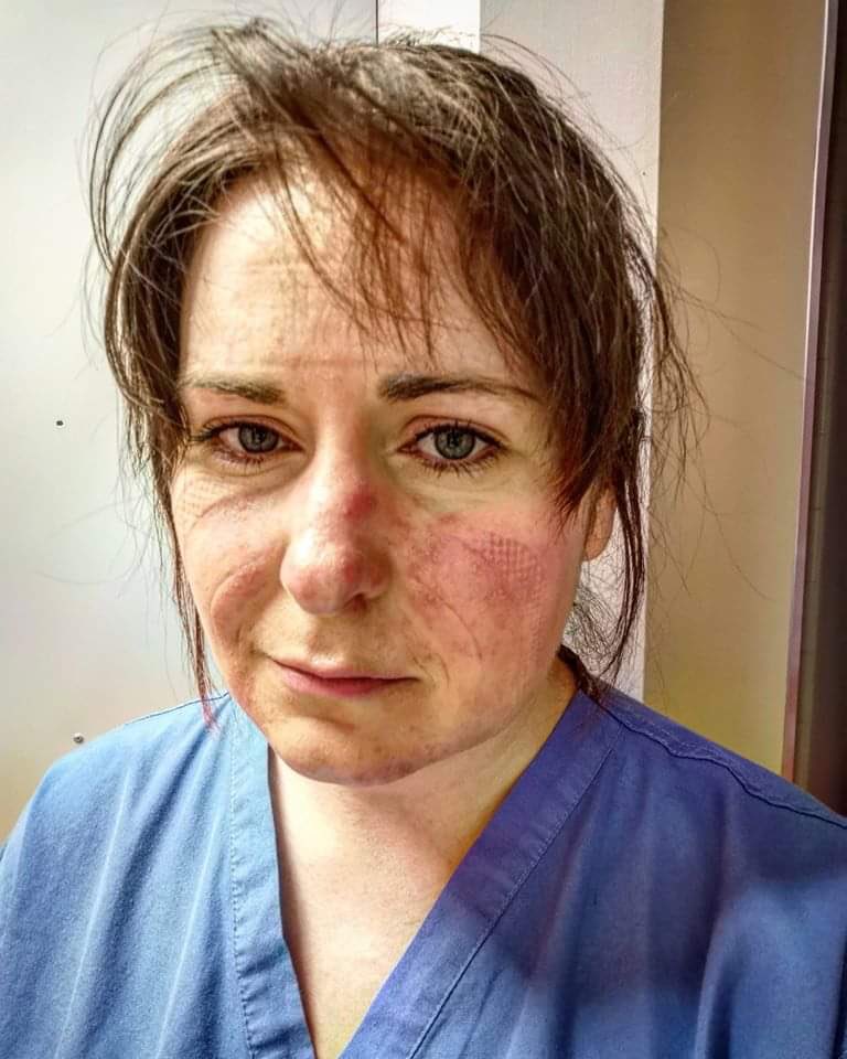 This is actually what hard work looks like. Think on the rest of us. #NHSForever