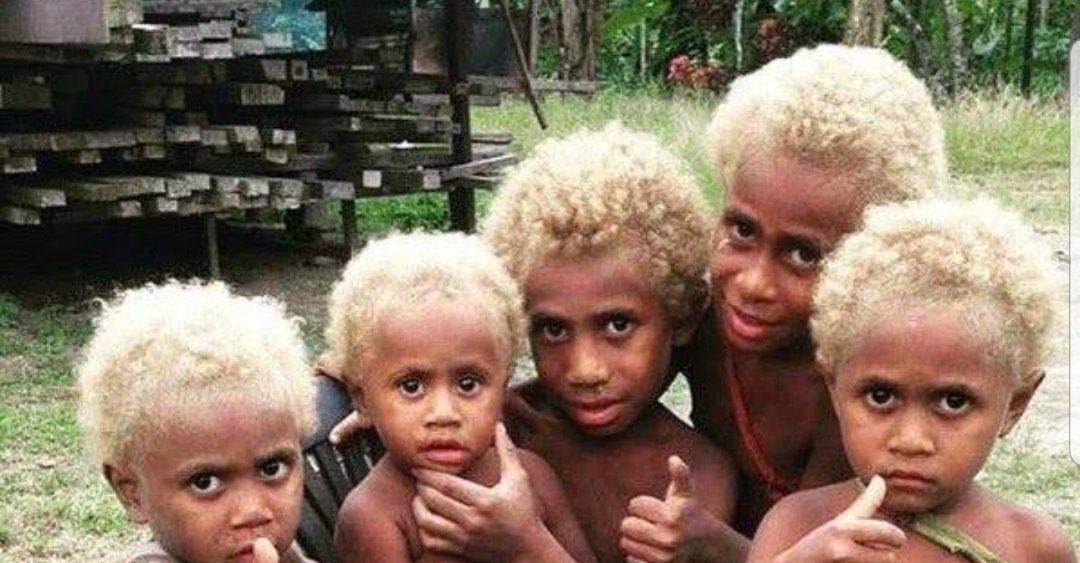 Melanasians, the major group of Torres Islanders a tribe of Indigenous Australians, are the only black people with natural independent blonde hair attributed to a particular gene.