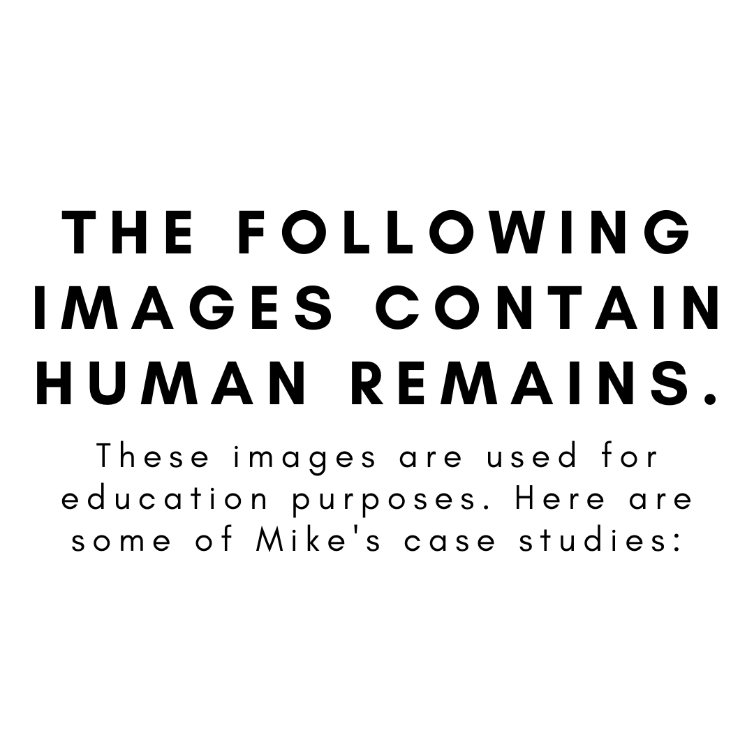 CUBALab's tweet photo. #StudentSpotlightSunday ft PhD student @Michaellegge91! Mike's thesis is an integrated study of the treatment of the dead in the Iron Age of E. England, combining archaeological, taphonomic &osteo methods to discern regional funerary narratives &population demographics.#CUArch100 https://t.co/PU8lEryo8w