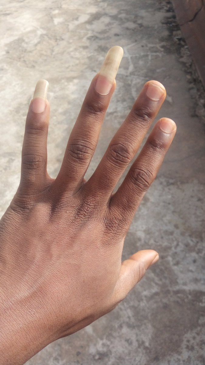 How long is your natural nails? Let's make it a thread. I will go first.