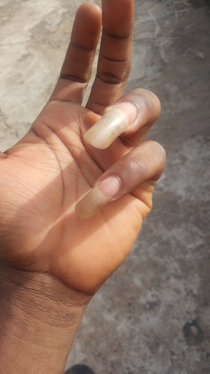 How long is your natural nails? Let's make it a thread. I will go first.