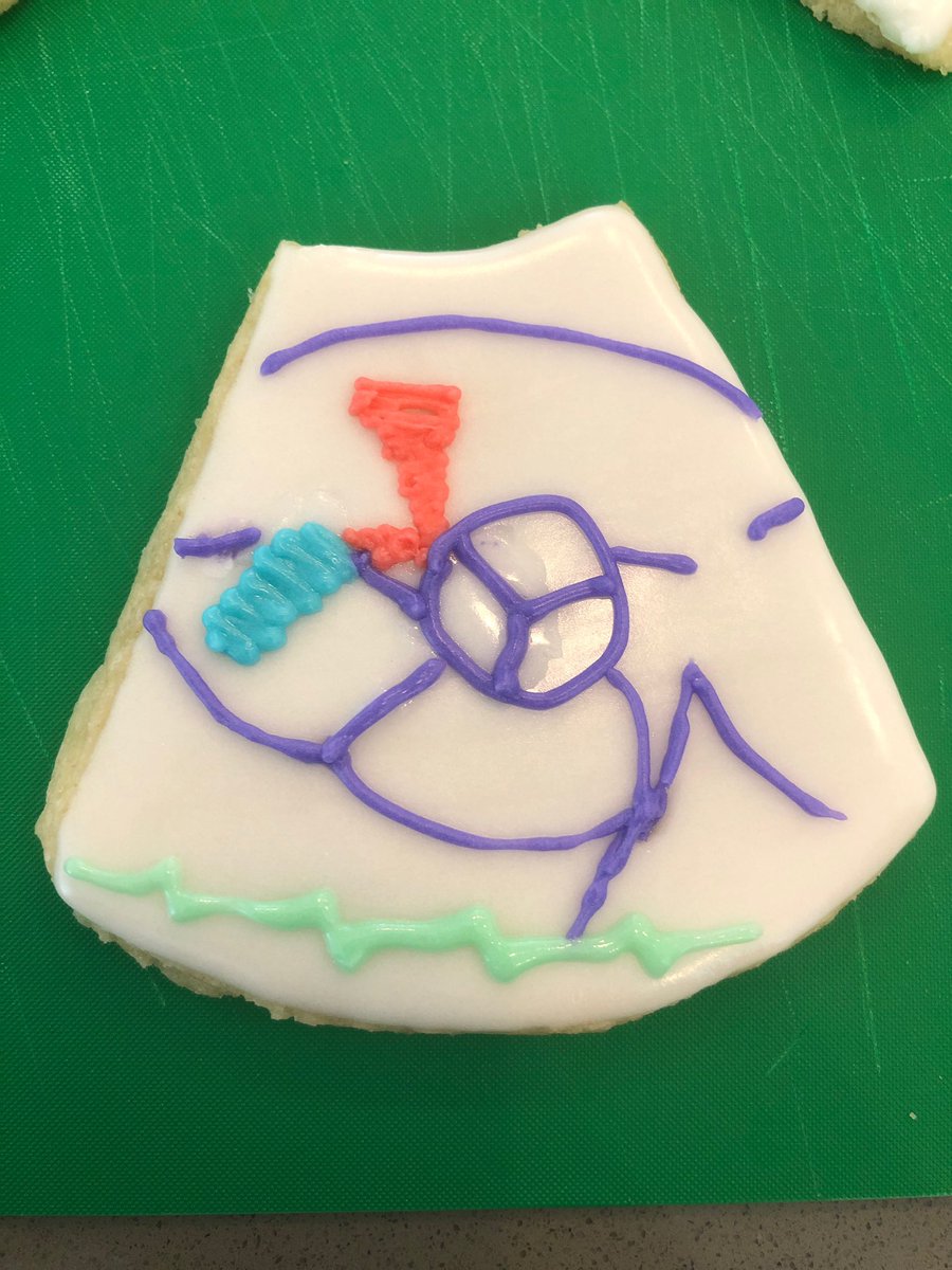 Roberto M Lang (@robertomlang) on Twitter photo Example of culinary echo. Cookies made by our cardiology fellows. Please explain the red jet. <a href="/ASE360/">American Society of Echocardiography</a> <a href="/AkhilNarangMD/">Akhil Narang, MD</a> <a href="/AmitRPatelMD/">Amit R. Patel</a> @amitasinghmd <a href="/AddK007/">Karima Addetia</a> Example of culinary echo. Cookies made by our cardiology fellows. Please explain the red jet. <a href="/ASE360/">American Society of Echocardiography</a> <a href="/AkhilNarangMD/">Akhil Narang, MD</a> <a href="/AmitRPatelMD/">Amit R. Patel</a> @amitasinghmd <a href="/AddK007/">Karima Addetia</a>