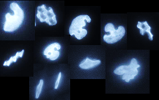 boer_jande's tweet photo. UFO's? Ghosts? Barbapapa? No, nuclei of mesenchymal stem cells grown on TopoChip surfaces. Who would have thought that nuclei are so flexible? Pictures taken by Aliaksei Vasilevich.
#TU Eindhoven #TopoChip #BioInterface Science https://t.co/0viv3V398i