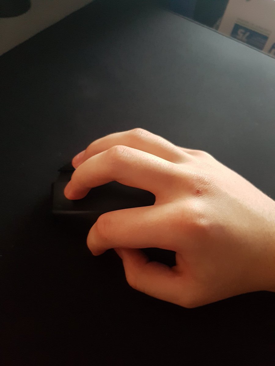 Yo what your mousegrip.