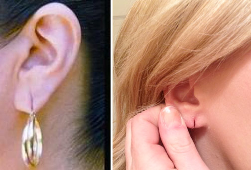 BalancedMD's tweet photo. You that is about to sleep with your earrings.. 

Sleeping with earrings can lead to;
-Torn earlobes 
-Infections such as cellulitis 
-Allergic dermatitis 
-Pain at the site or Headaches 
-Poor sleeping posture 

No earrings in bed!!
#HealthEdMatters https://t.co/9o4oIRJDzS