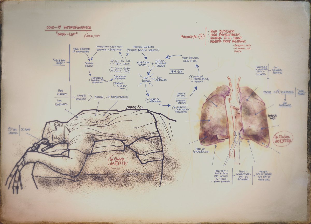 Fallo resp COVID-19: catarro, neumonía (fenot L) y luego SDRA "atipico" (fenot H) Intubar temprano x insuf resp hipox? 

Comp: sketchbookmd.com/2020/04/14/cov…
#graphicmedicine #sketchnote #coronavirus #COVIDー19 #sarscov2 #foam #foamed #foamems #meded #foamcc #covid19primaria #enarm #mir