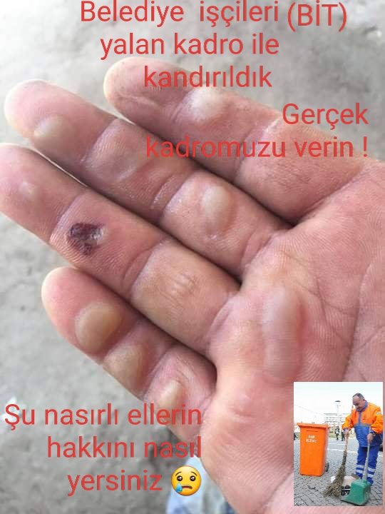 Farabbaa's tweet photo. Heryeri ilaçlayan dezenfekte eden biziz Türkiyenin Çöpü Pisliğini Temizleyen Biziz Bizi Gören Yok #belediyeşirketişçilerinekadro
#işçilerunutmaz3
@tcbestepe @ZehraZumrutS @vedatbilgn @emrullahisler @NumanKurtulmus @ifarukaksu @yasaryldrmMHP @alibabacan @Ahmet_Davutoglu @BY https://t.co/Q1Qy7H70Pu