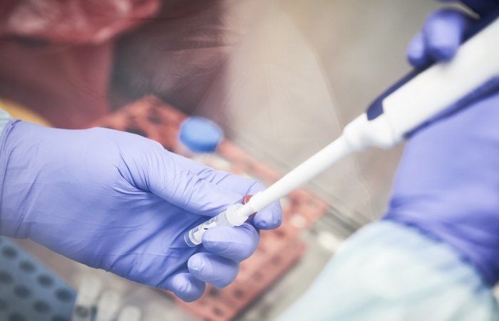 DiarioPE's tweet image. Governo federal ameaça de novo tomar medidas contra ações de governadores e prefeitos na pandemia bit.ly/3efgsba