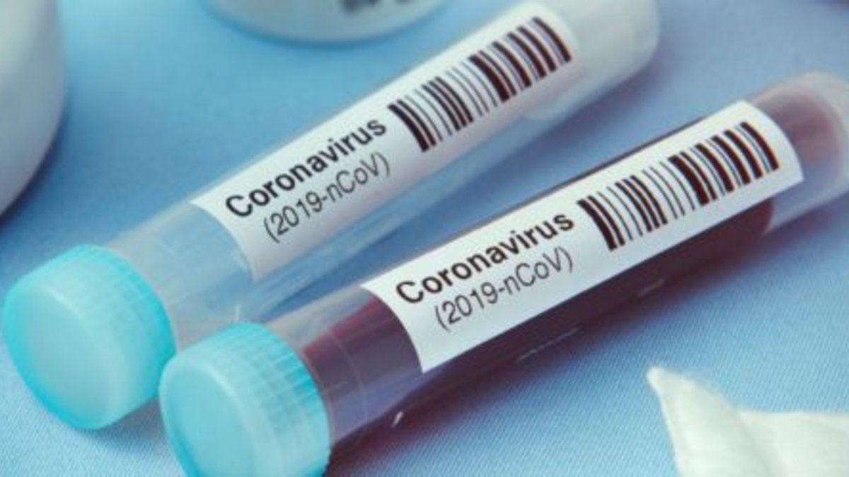 radio5_rne's tweet photo. El @ibsGRANADA está probando la efectividad contra el corovanirus de un medicamento para el tratamiento de la hepatitis B y C.

▪ Piden el apoyo de la UE para realizar un ensayo clínico sobre 100 pacientes.

@RTVEAndalucia 

🔊 https://t.co/VwD33pSEfG https://t.co/q3Mvd0ypH0